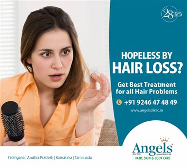 Best Hair loss Treatment in India - Angels Advanced Clinic  | Sports  & Health classifieds,Telangana
